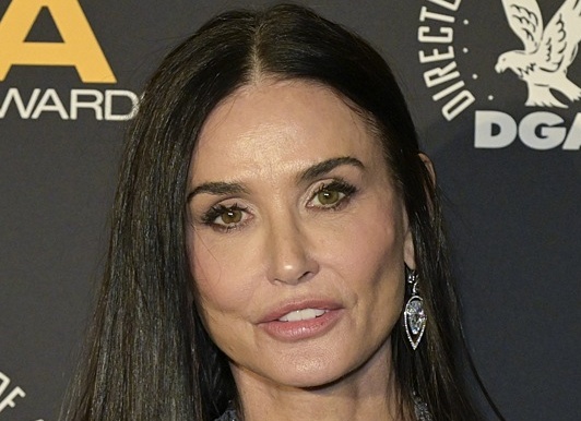 Зудина, Пугачева и Деми Мур заполучили «улыбку Джокера»: откуда взялся жуткий антитренд